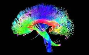Dr. Thomas Barrick: Brain pathways. A colored 3-D MRI scan of the brain's white matter pathways traces connections between cells in the cerebrum and the brainstem.