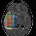 Neurosurgery research