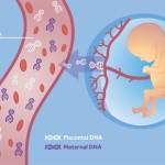 St George’s scores a first in providing more accurate screening for Down’s syndrome