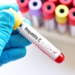 Hepatitis C treatment